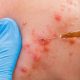 A Cosmetician Injecting A Persons Face.
