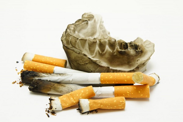 Image represents adverse effect of teeth demonstration after using Nicotine or Tobacco smoking and chewing
